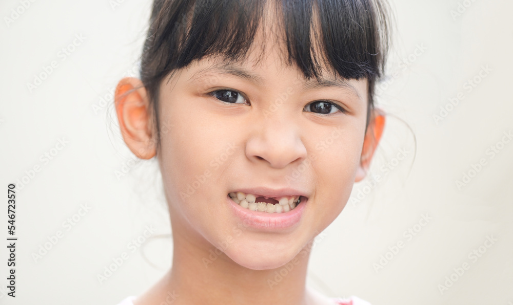 Foto Stock lost milk teeth lost baby tooth , smile face of a child