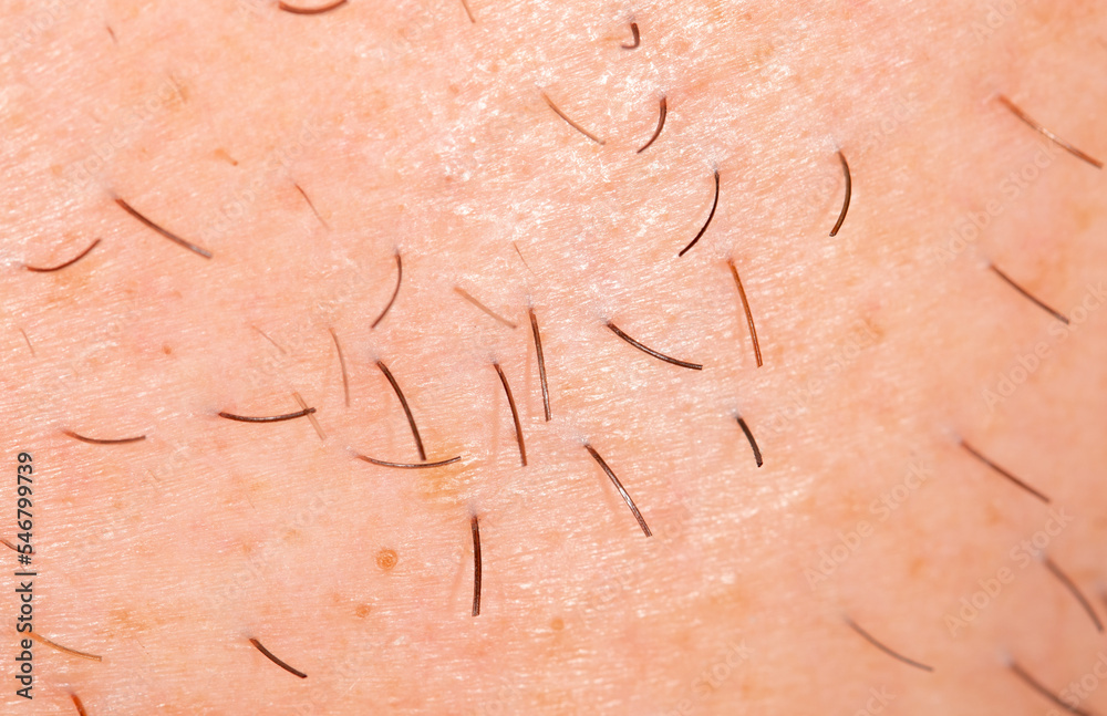 Fototapeta premium Hair on the skin of a man's face. Macro