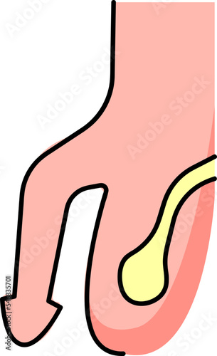 The male genital organs which are part of the reproductive system consist of the penis, testicles, vas deferens and other spermatic cords, as well as the prostate gland
