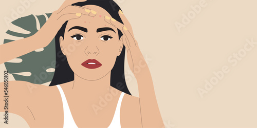 Woman with acne. Beautiful girl in white t-shirt squeezing pimpile on her face. Skin problem concept. Vector illustration.