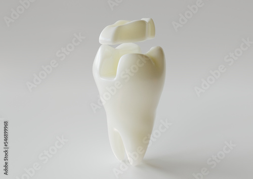 Bild auf Leinwand Ceramic Inlay crown over a tooth- 3D Rendering