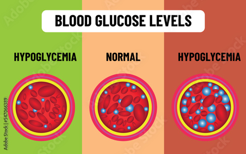 Blood glucose levels. hunger satiety, sugar level