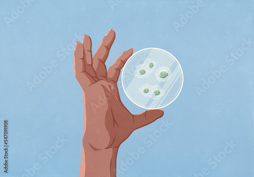 Close up hand holding petri dish with bacteria
 photo