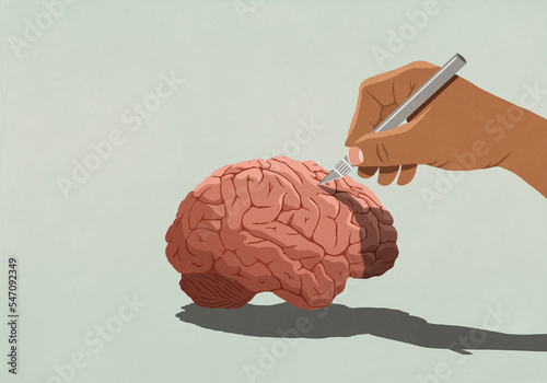 Hand with surgical knife dissecting brain
 photo