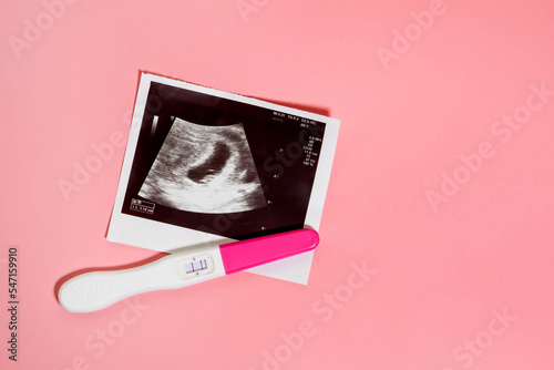 Photo of ultrasound and pregnancy test on a pastel pink background. Positive pregnancy test photo