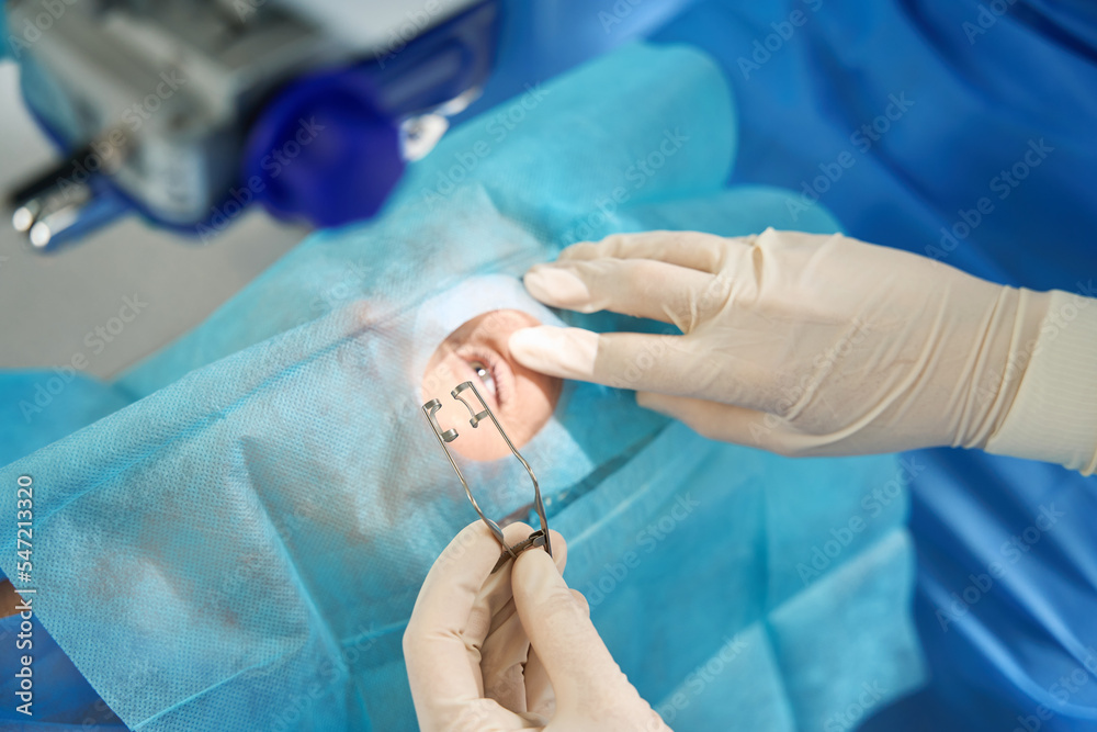 Close-up photo of doctor holding eyelid expander during surgery Close-up photo of doctor holding eyelid expander during surgery