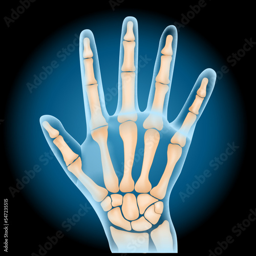 Carpal bones. x-ray blue realistic palm on dark background.