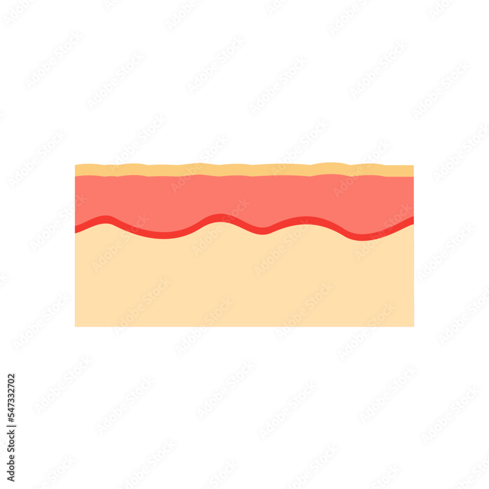 Vector Illustration Of Human Skin. The Epidermis Of Skin Anatomy ...