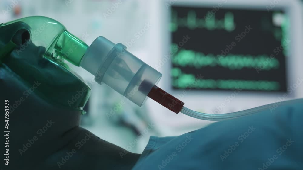 A female patient in medical mask is breathing oxygen support in a hospital with ecg heart rate machine. Unhealthy woman in coma. Getting mechanical ventilation. Concept of pandemic and therapy