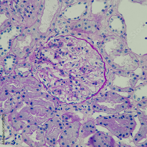 Camera photo of normal glomeruli and renal tubules, PAS stain, magnification 400x, photograph through a microscope