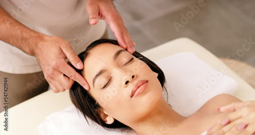 Woman, relax and facial acupuncture in skincare, cosmetics or beauty spa treatment at the resort. Female face relaxing for healthy, zen and physical therapy with acupuncturist needles in wellness