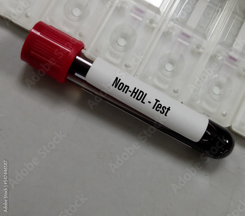 Blood sample for Non-HDL test. Good cholesterol. CKD photo