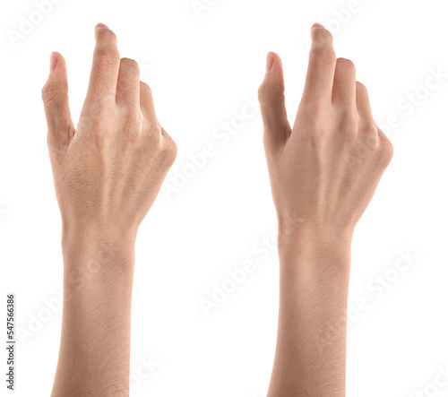 Collage with photos of woman showing hands with dry and moisturized skin on white background, closeup