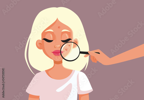 Young Woman Dealing with Acne Undergoing Dermatological Examination. Dermatologist using a magnifier for skin clinical exam 