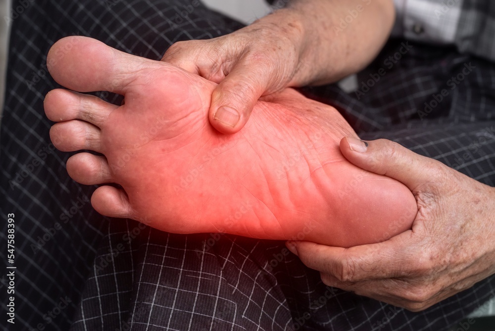 Tingling and burning sensation in foot of Asian man. Foot pain. Sensory