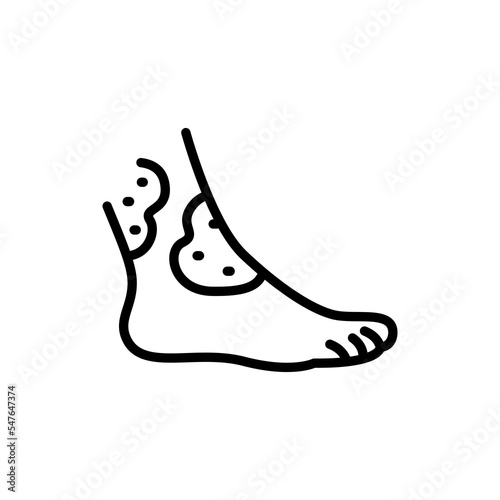 Atopic dermatitis black line icon. Dermatology disease.