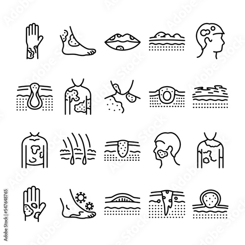Skin diseases line icons set. Dermatology problems
