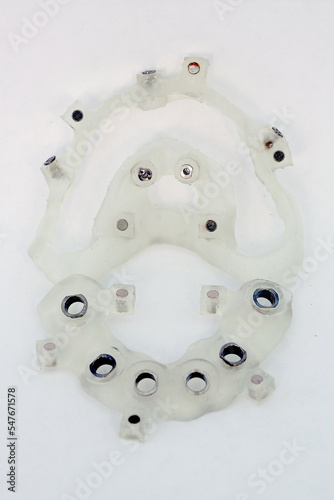 Collapsible printed dental surgical template. Navigational surgical guide for dental implantation