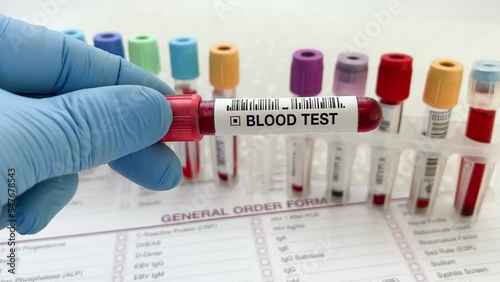 Doctor holding Blood test tube for analysis of blood chemist study in the laboratory. Lab technician assistant or doctor holding a blood testing over requisition report for analysis chemistry photo