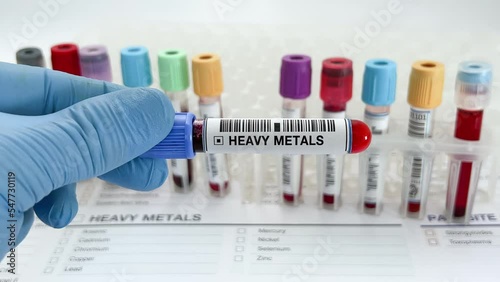 Doctor holding Blood sample tube for analysis of heavy metals in laboratory. Lab technician holding a blood testing over requisition report for heavy metals test photo
