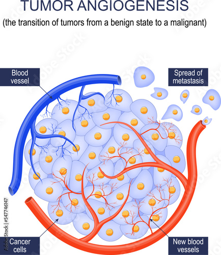 Tumor angiogenesis photo