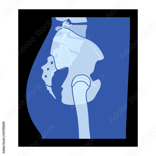 X-Ray pelvis Skeleton Hip Human body Bones adult people roentgen side view. 3D realistic flat blue color concept Vector illustration of medical anatomy isolated on black background