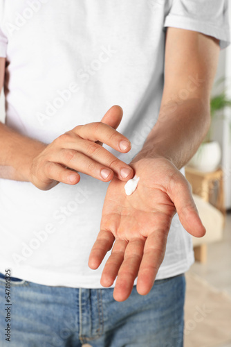 Man applying cream onto hand indoors, closeup