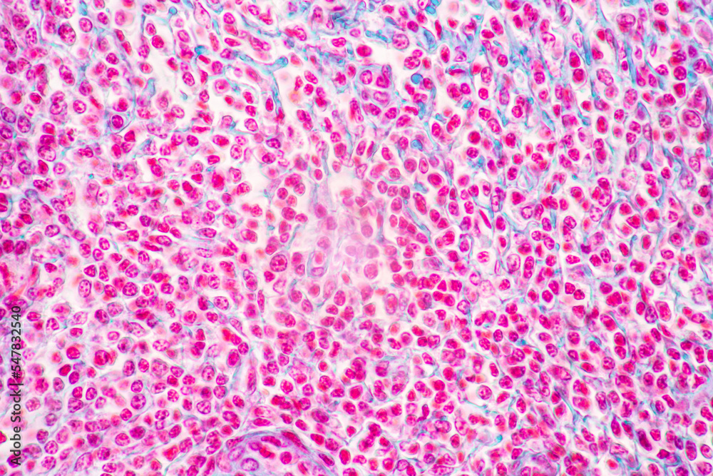 Backgrounds of Characteristics Tissue of Stomach Human, Small intestine Human, Pancreas Human and Large intestine Human under the microscope in Lab. Backgrounds of Characteristics Tissue of Stomach Human, Small intestine Human, Pancreas Human and Large intestine Human under the microscope in Lab.