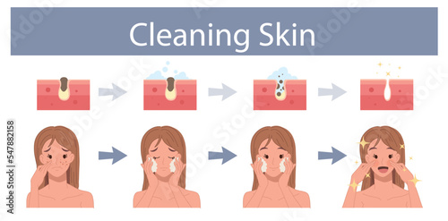 Facial skin care, pore cleaning concept. woman with Cleansing stages on clogged face. Skin cleaning steps. Vector cartoon illustration.