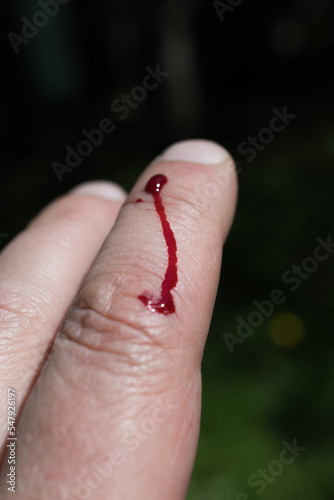 Injured finger and drop of blood.