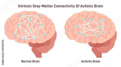 Intrinsic gray-matter connectivity of autistic brain. Neurodevelopmental photo