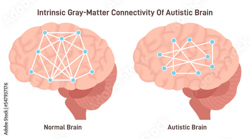 Intrinsic gray-matter connectivity of autistic brain. Neurodevelopmental