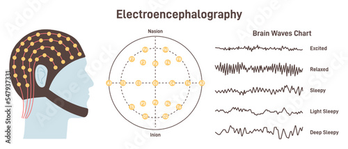 Electroencephalography. Medical test that measures electrical activity