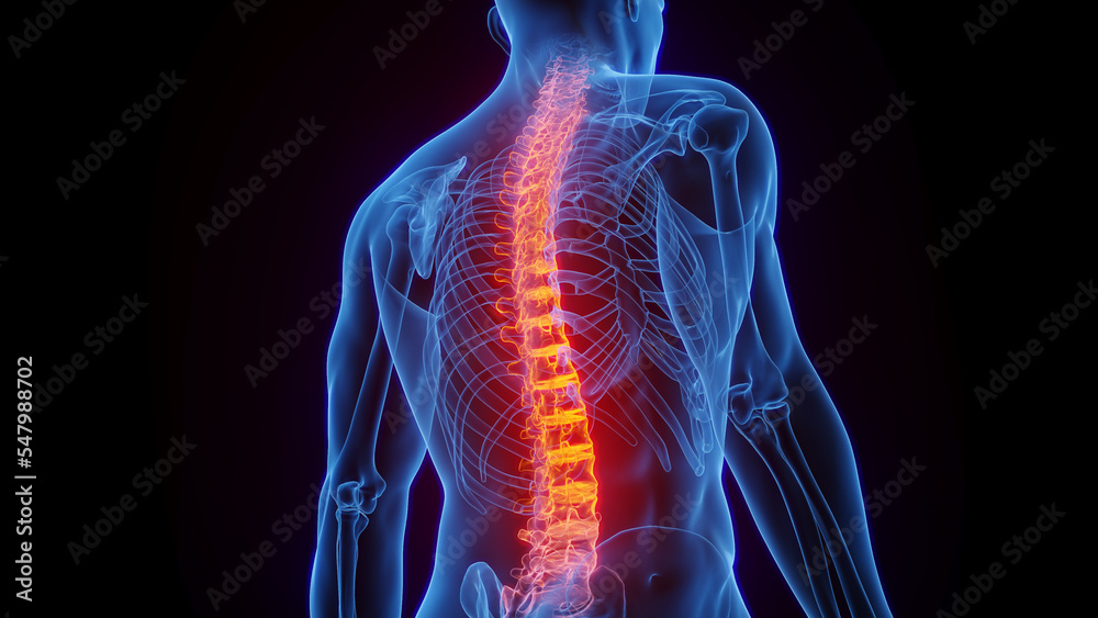 3D rendered Medical Illustration of Male Anatomy - Inflamed Spine. - obrazy, fototapety, plakaty 