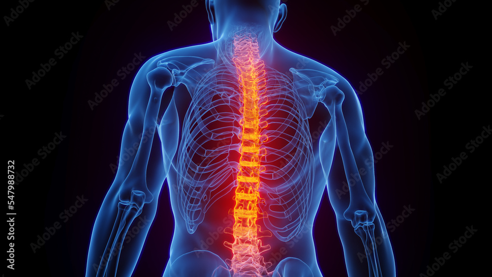 3D rendered Medical Illustration of Male Anatomy - Inflamed Spine. 3D rendered Medical Illustration of Male Anatomy - Inflamed Spine.