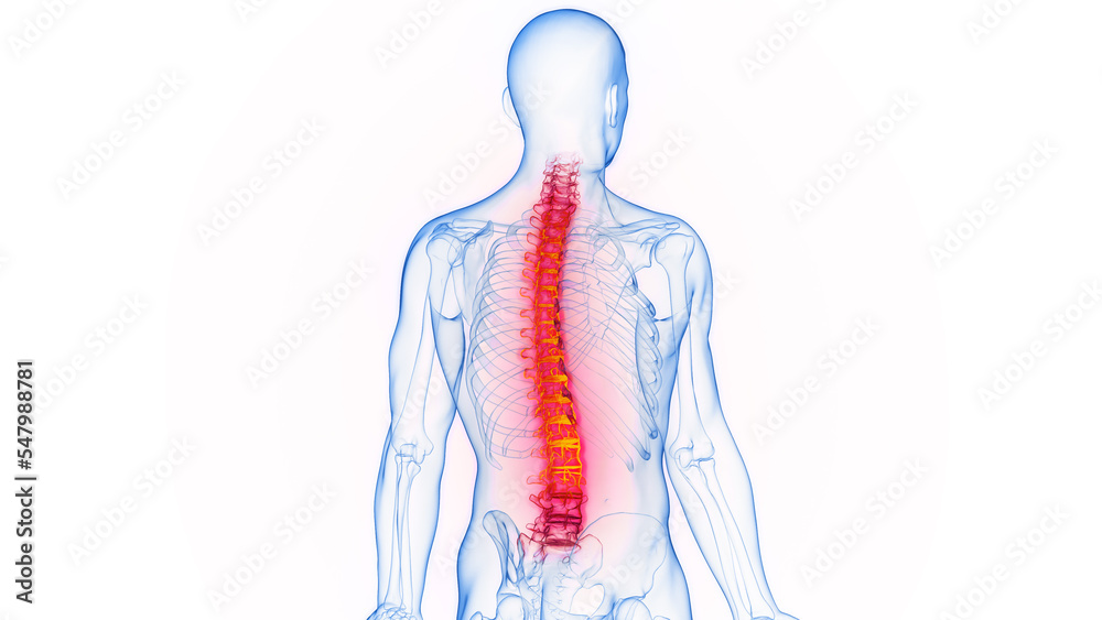 3D rendered Medical Illustration of Male Anatomy - Inflamed Spine.