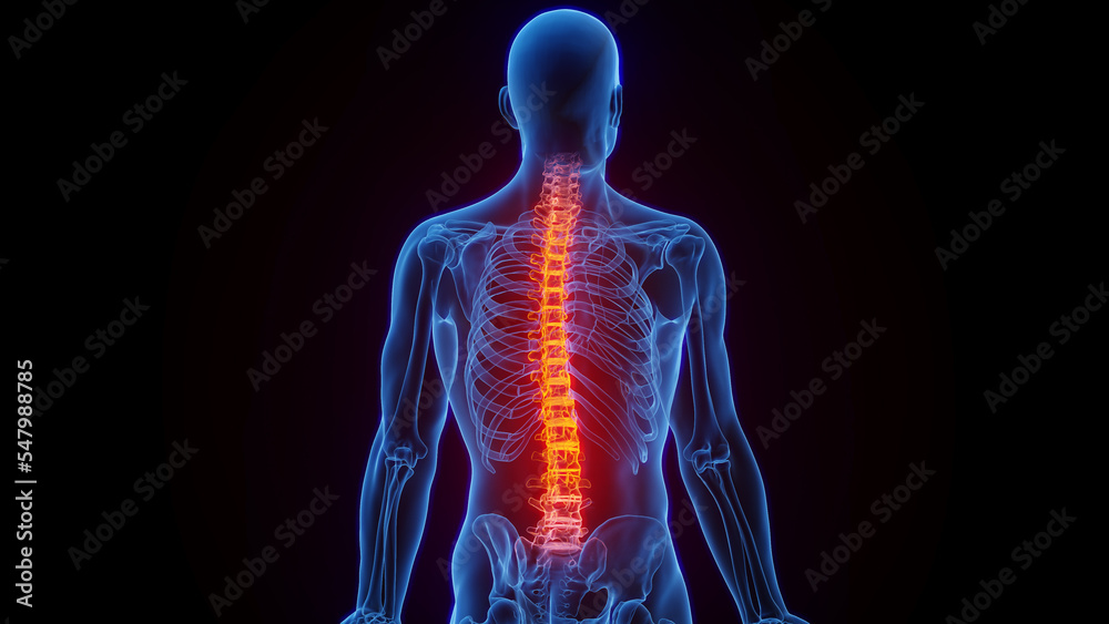 3D rendered Medical Illustration of Male Anatomy - Inflamed Spine.