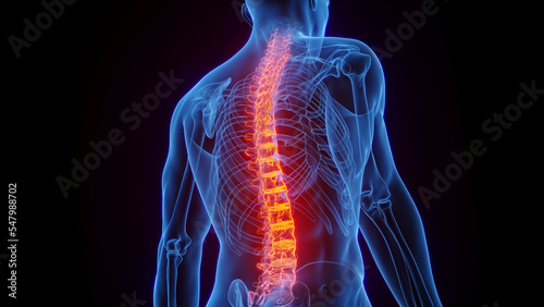 3D rendered Medical Illustration of Male Anatomy - Inflamed Spine.