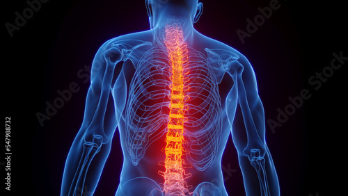 3D rendered Medical Illustration of Male Anatomy - Inflamed Spine.