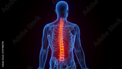 3D rendered Medical Illustration of Male Anatomy - Inflamed Spine.