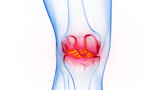 3D rendered Medical Illustration of Male Anatomy - Inflamed Knee.