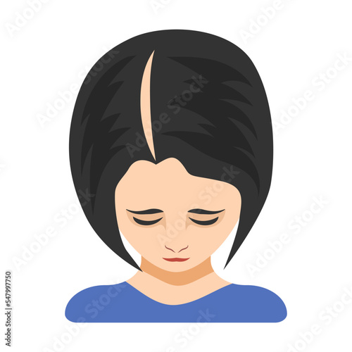 First stage of alopecia in women vector illustration. Top of female head with bald spot on scalp isolated on white background. Health, hair loss or treatment