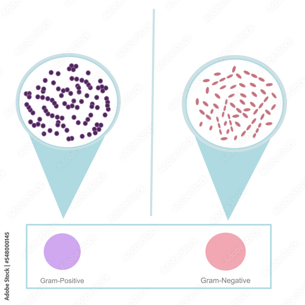 Vecteur Stock The interpretation result of gram’s stain technique on
