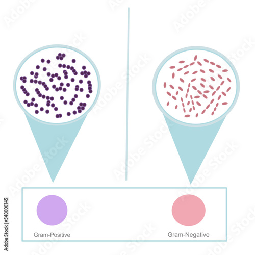 The interpretation result of gram’s stain technique on glass slide after staining with specific chemical ( Crystal violet , Iodine and Safranin) : Gram-Positive and Negative bacteria