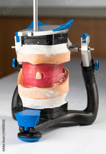 Dental articulator with dental models and dental total prosthesis photo
