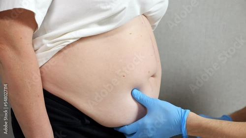 Hands of doctor in rubber gloves examine belly of female patient against grey wall. Woman with excess weight gets prepared for plastic surgery closeup
