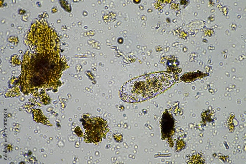 human parasites in the human gut photo