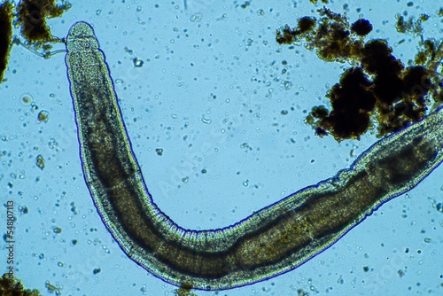 insect parasite in the soil in australia photo