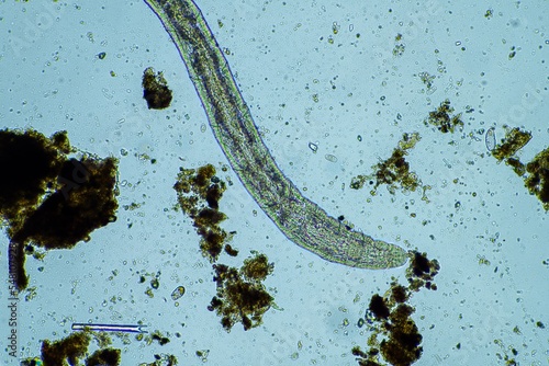 microscopic worm in the soil in australia