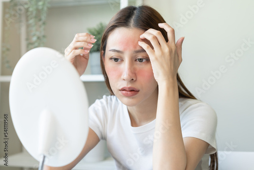 Dermatology, scratch asian young woman looking at mirror, expression worry and itch, itchy allergy or allergic sensitive reaction, red spot or rash on her face. Beauty care from skin problem treatment